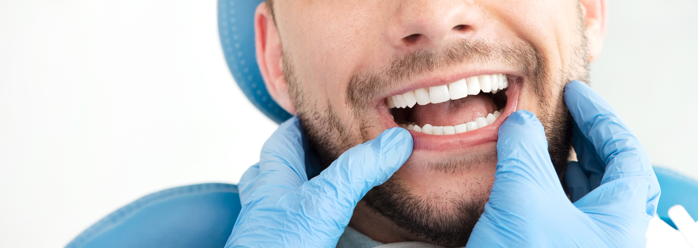 Man Having Teeth Examined by Dentist